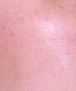 R00125662 R00125662